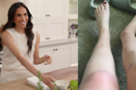 Meghan Markle Sued for $10M After Shocking Incident Leaves Fan with Catastrophic Burns