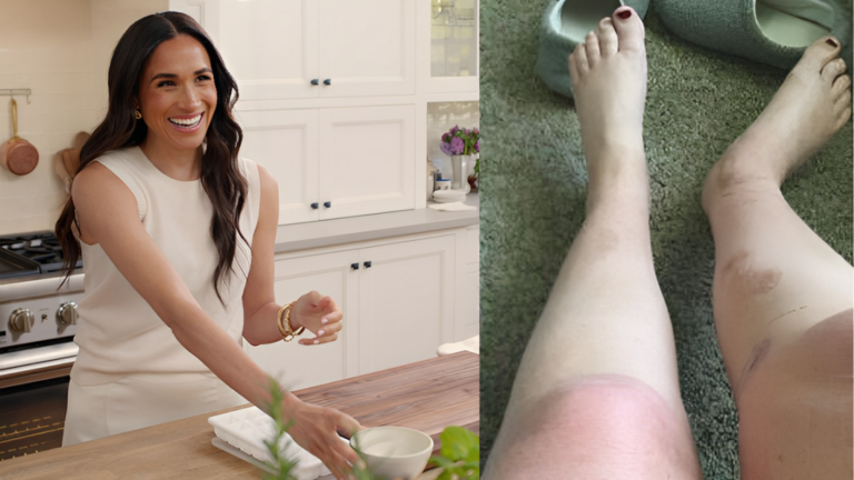Meghan Markle Sued for $10M After Shocking Incident Leaves Fan with Catastrophic Burns